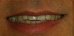 colorado springs dentistry