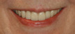 cosmetic dentist colorado springs co