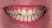 cosmetic dentist colorado springs