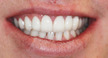 colorado springs cosmetic dentist